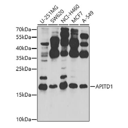 Western Blot - Anti-MHF1 Antibody (A10387) - Antibodies.com