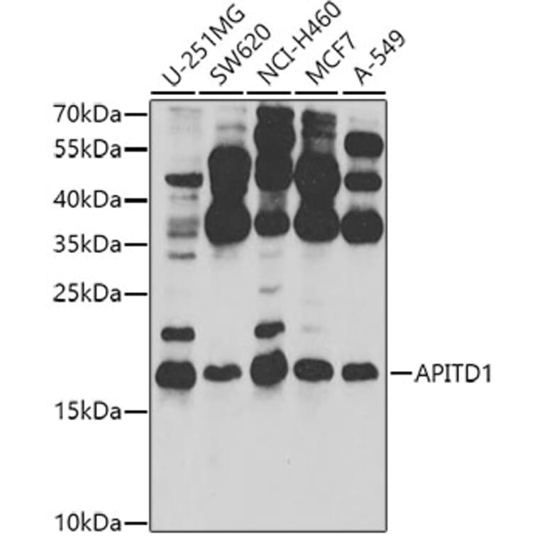 Western Blot - Anti-MHF1 Antibody (A10387) - Antibodies.com