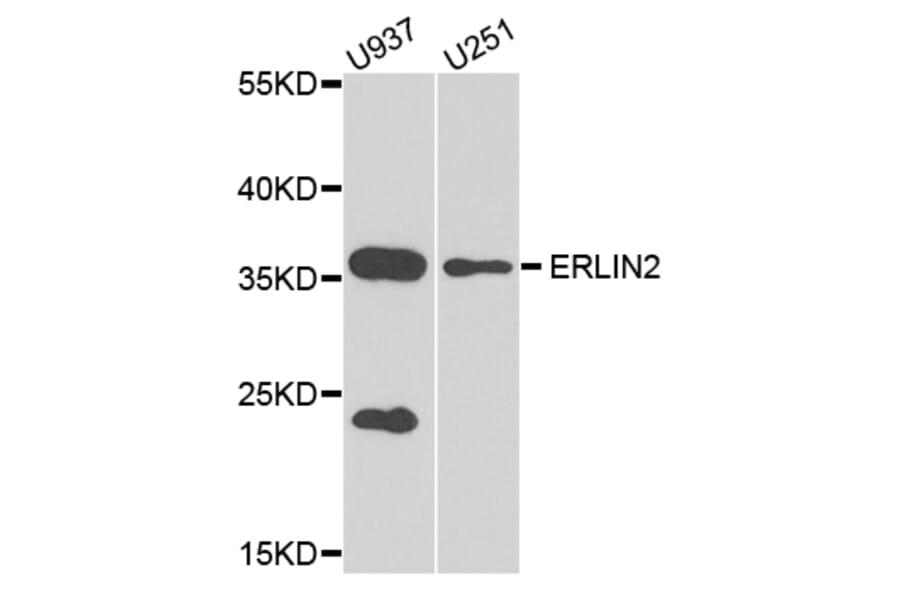 Western Blot - Anti-ERLIN2 Antibody (A8314) - Antibodies.com