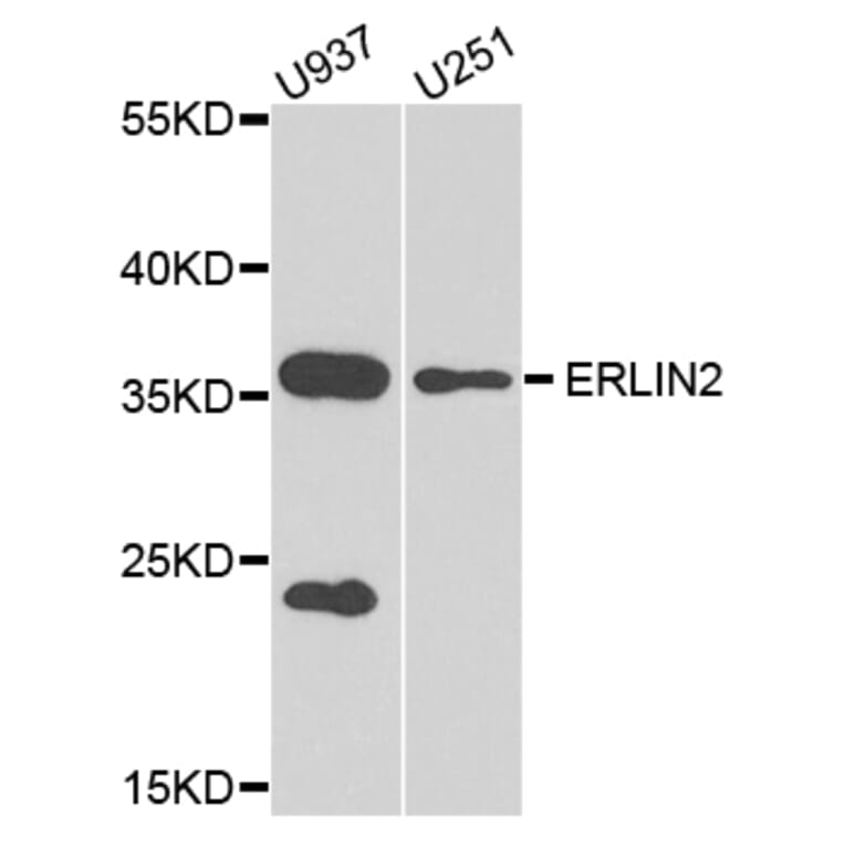 Western Blot - Anti-ERLIN2 Antibody (A8314) - Antibodies.com