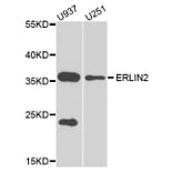 Western Blot - Anti-ERLIN2 Antibody (A8314) - Antibodies.com