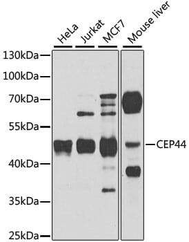 Western blot analysis of extracts of various cell lines, using Anti-CEP44 Antibody (A8317) at 1:1,000 dilution.
Secondary antibody: Goat Anti-Rabbit IgG (H+L) (HRP) (AS014) at 1:10,000 dilution.
Lysates / proteins: 25µg per lane.
Blocking buffer: 3% non-fat dry milk in TBST.
Detection: ECL Basic Kit (RM00020).
Exposure time: 60s.