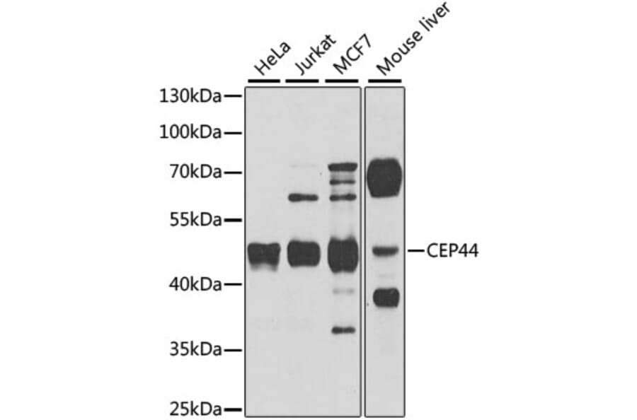 Western Blot - Anti-CEP44 Antibody (A10392) - Antibodies.com