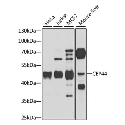 Western Blot - Anti-CEP44 Antibody (A10392) - Antibodies.com