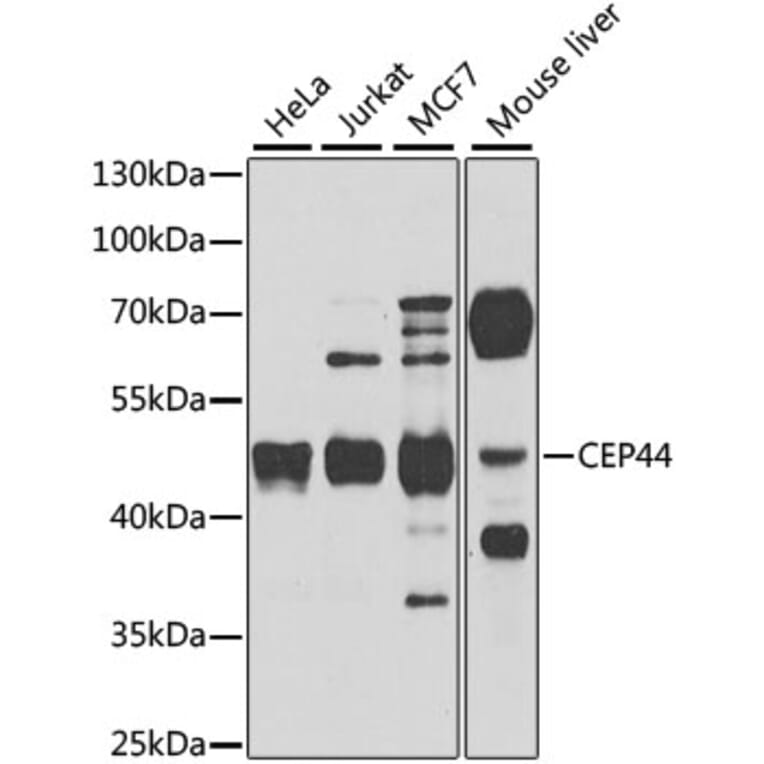 Western Blot - Anti-CEP44 Antibody (A10392) - Antibodies.com