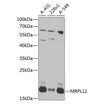 Western Blot - Anti-MRPL12 Antibody (A10393) - Antibodies.com