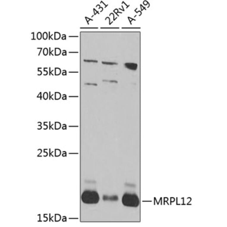 Western Blot - Anti-MRPL12 Antibody (A10393) - Antibodies.com