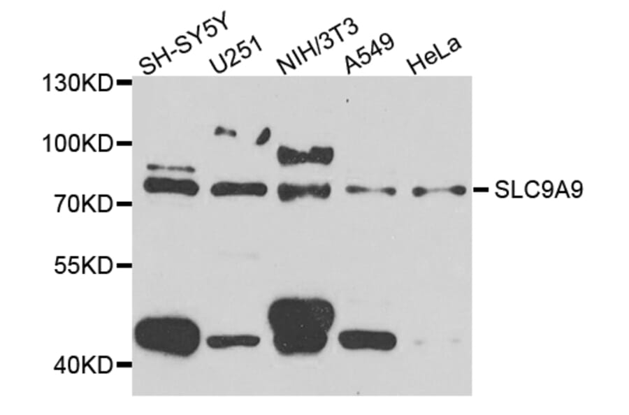 Western Blot - Anti-SLC9A9 Antibody (A8323) - Antibodies.com