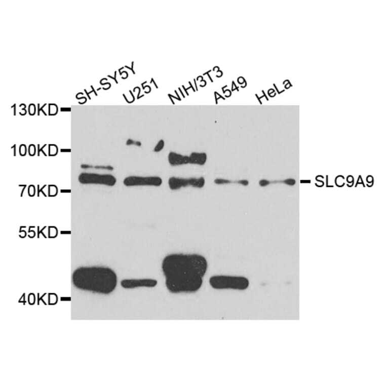 Western Blot - Anti-SLC9A9 Antibody (A8323) - Antibodies.com