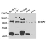 Western Blot - Anti-SLC9A9 Antibody (A8323) - Antibodies.com
