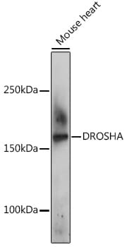 Western blot analysis of extracts of K-562 cells, using Anti-DROSHA Antibody (A8336) at 1:1,000 dilution.
Secondary antibody: Goat Anti-Rabbit IgG (H+L) (HRP) (AS014) at 1:10,000 dilution.
Lysates / proteins: 25µg per lane.
Blocking buffer: 3% non-fat dry milk in TBST.
Detection: ECL Basic Kit (RM00020).
Exposure time: 90s.