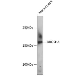 Western Blot - Anti-Drosha Antibody (A10395) - Antibodies.com