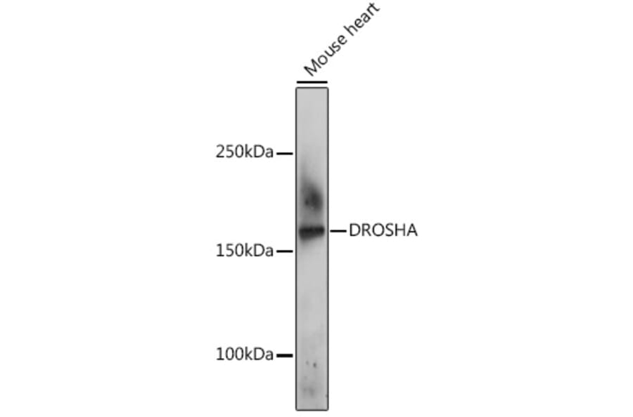 Western Blot - Anti-Drosha Antibody (A10395) - Antibodies.com