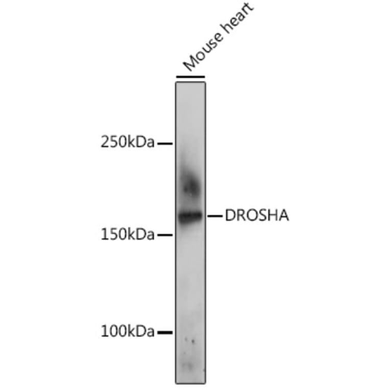 Western Blot - Anti-Drosha Antibody (A10395) - Antibodies.com