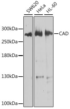 Western blot analysis of extracts of various cell lines, using Anti-CAD Antibody (A8344) at 1:1,000 dilution.
Secondary antibody: Goat Anti-Rabbit IgG (H+L) (HRP) (AS014) at 1:10,000 dilution.
Lysates / proteins: 25µg per lane.
Blocking buffer: 3% non-fat dry milk in TBST.
Detection: ECL Basic Kit (RM00020).
Exposure time: 10s.