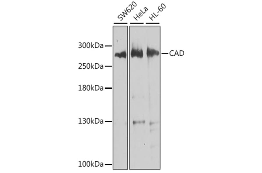Western Blot - Anti-CAD/BM1 Antibody (A10396) - Antibodies.com