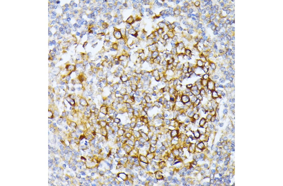 Immunohistochemistry - Anti-CAD/BM1 Antibody (A10396) - Antibodies.com
