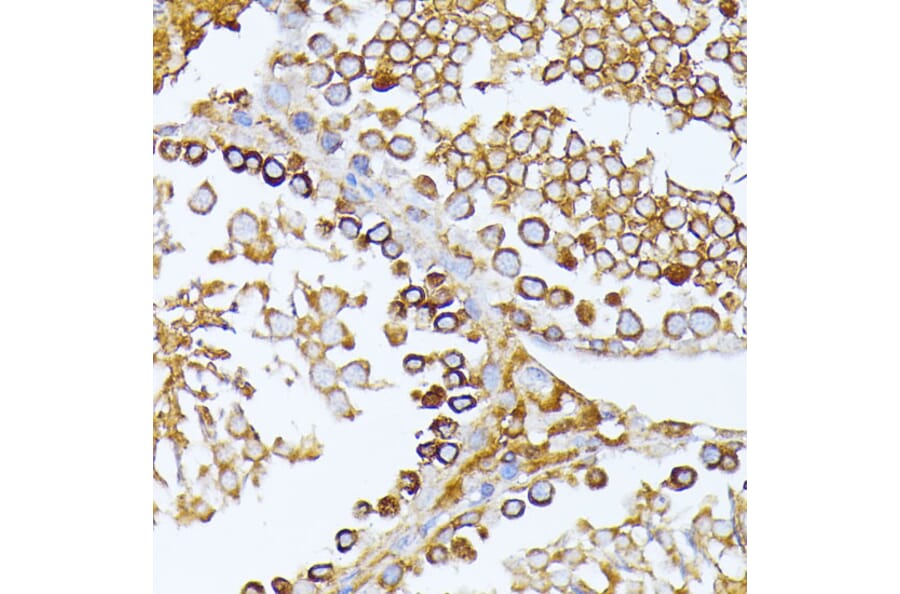 Immunohistochemistry - Anti-CAD/BM1 Antibody (A10396) - Antibodies.com