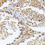 Immunohistochemistry - Anti-CAD/BM1 Antibody (A10396) - Antibodies.com