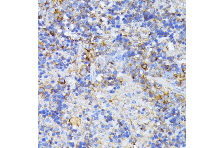 Immunohistochemistry - Anti-CAD/BM1 Antibody (A10396) - Antibodies.com