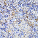 Immunohistochemistry - Anti-CAD/BM1 Antibody (A10396) - Antibodies.com