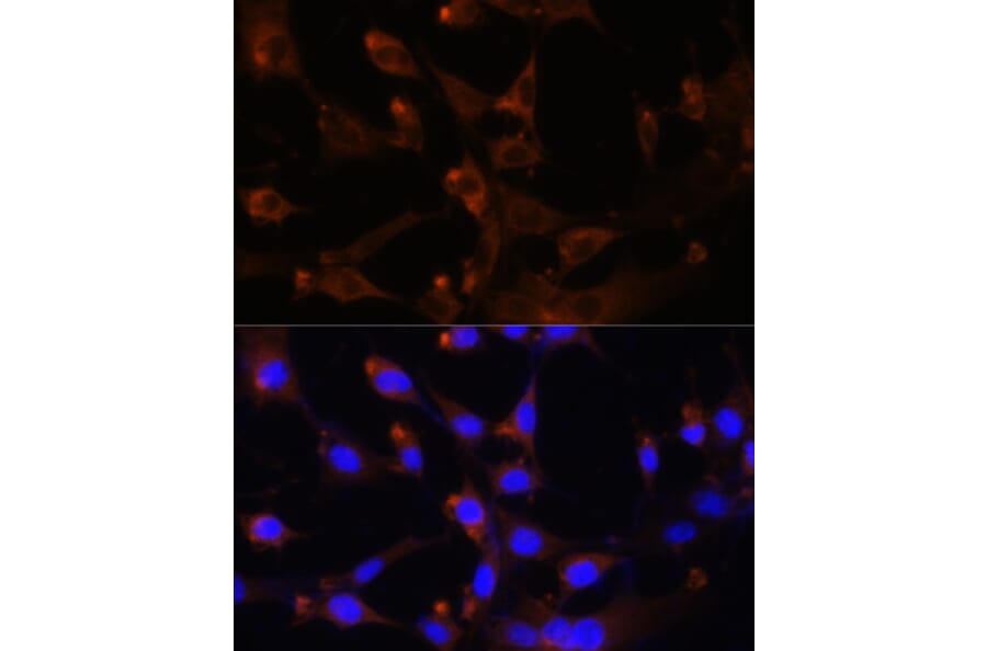 Anti-CAD Antibody (A10396) | Antibodies.com