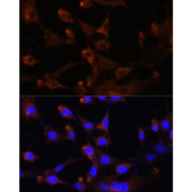 Immunofluorescence - Anti-CAD/BM1 Antibody (A10396) - Antibodies.com