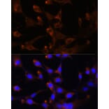 Immunofluorescence - Anti-CAD/BM1 Antibody (A10396) - Antibodies.com