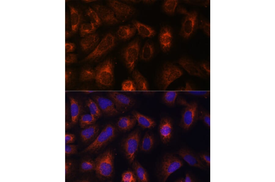Immunofluorescence - Anti-CAD/BM1 Antibody (A10396) - Antibodies.com