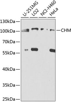 Western blot analysis of extracts of various cell lines, using Anti-CHM Antibody (A8345) at 1:1,000 dilution. Secondary antibody: Goat Anti-Rabbit IgG (H+L) (HRP) (AS014) at 1:10,000 dilution. Lysates / proteins: 25µg per lane. Blocking buffer: 3% non-fat dry milk in TBST. Detection: ECL Enhanced Kit (RM00021). Exposure time: 5s.