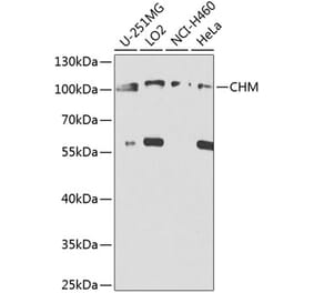 Western Blot - Anti-CHM Antibody (A8345) - Antibodies.com