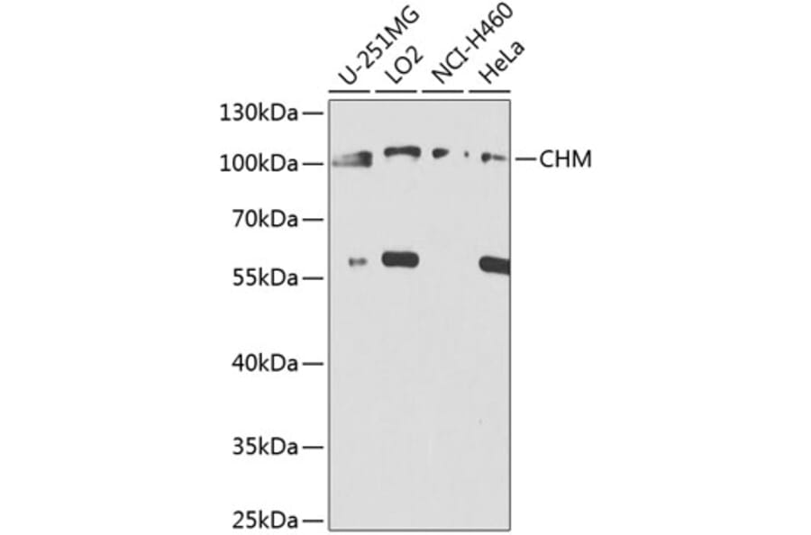 Western Blot - Anti-CHM Antibody (A8345) - Antibodies.com