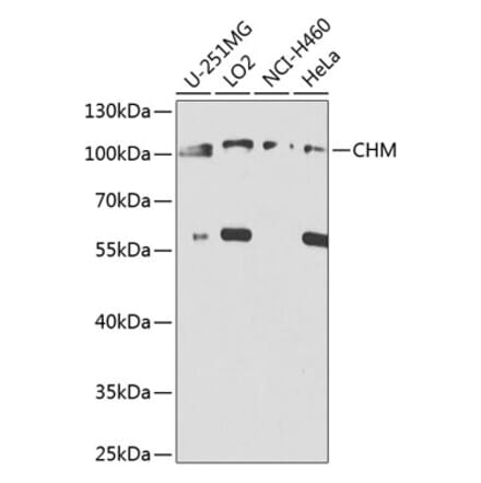 Western Blot - Anti-CHM Antibody (A8345) - Antibodies.com