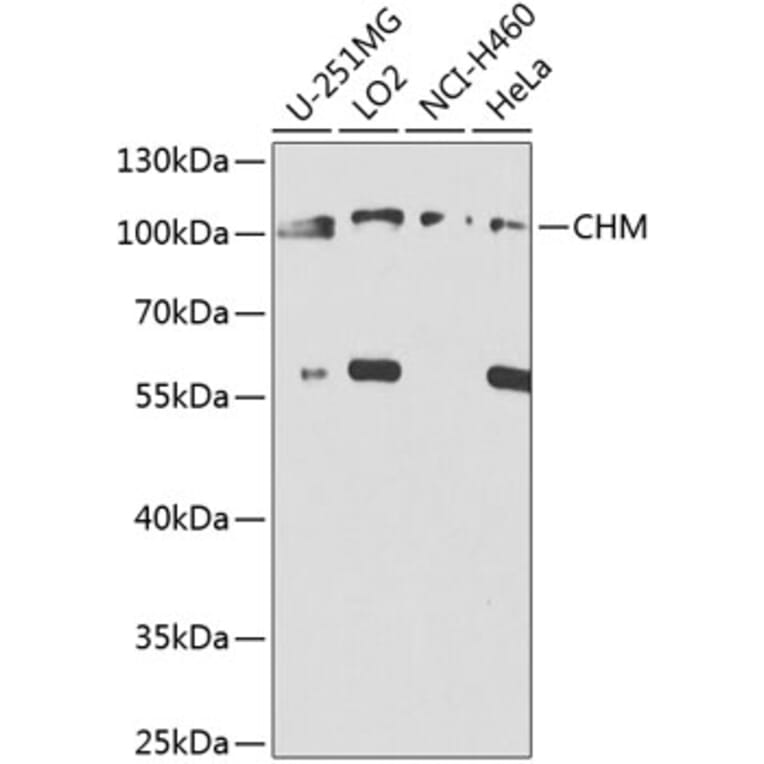 Western Blot - Anti-CHM Antibody (A8345) - Antibodies.com