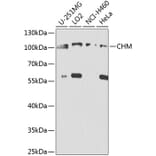 Western Blot - Anti-CHM Antibody (A8345) - Antibodies.com