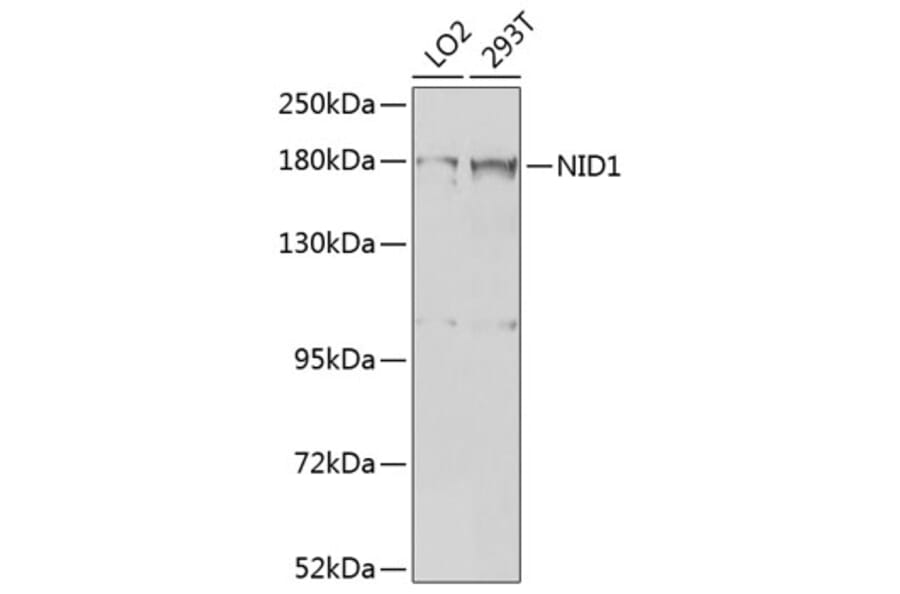 Western Blot - Anti-Entactin/NID Antibody (A10398) - Antibodies.com