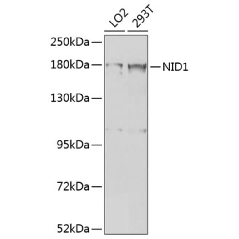 Western Blot - Anti-Entactin/NID Antibody (A10398) - Antibodies.com