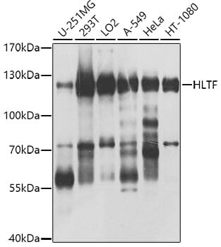 Western blot analysis of extracts of various cell lines, using Anti-HLTF Antibody (A8353) at 1:1,000 dilution.
Secondary antibody: Goat Anti-Rabbit IgG (H+L) (HRP) (AS014) at 1:10,000 dilution.
Lysates / proteins: 25µg per lane.
Blocking buffer: 3% non-fat dry milk in TBST.
Detection: ECL Basic Kit (RM00020).
Exposure time: 5s.
