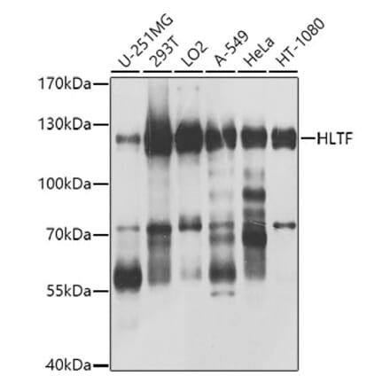 Western Blot - Anti-HLTF Antibody (A10399) - Antibodies.com