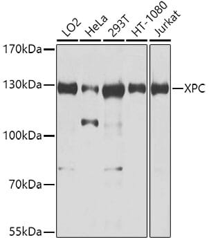 Western blot analysis of extracts of various cell lines, using Anti-XPC Antibody (A8354) at 1:1,000 dilution.
Secondary antibody: Goat Anti-Rabbit IgG (H+L) (HRP) (AS014) at 1:10,000 dilution.
Lysates / proteins: 25µg per lane.
Blocking buffer: 3% non-fat dry milk in TBST.
Detection: ECL Enhanced Kit (RM00021).
Exposure time: 5s.
