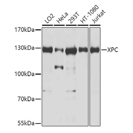 Western Blot - Anti-XPC Antibody (A10400) - Antibodies.com