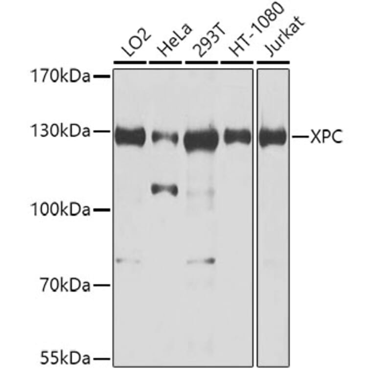 Western Blot - Anti-XPC Antibody (A10400) - Antibodies.com