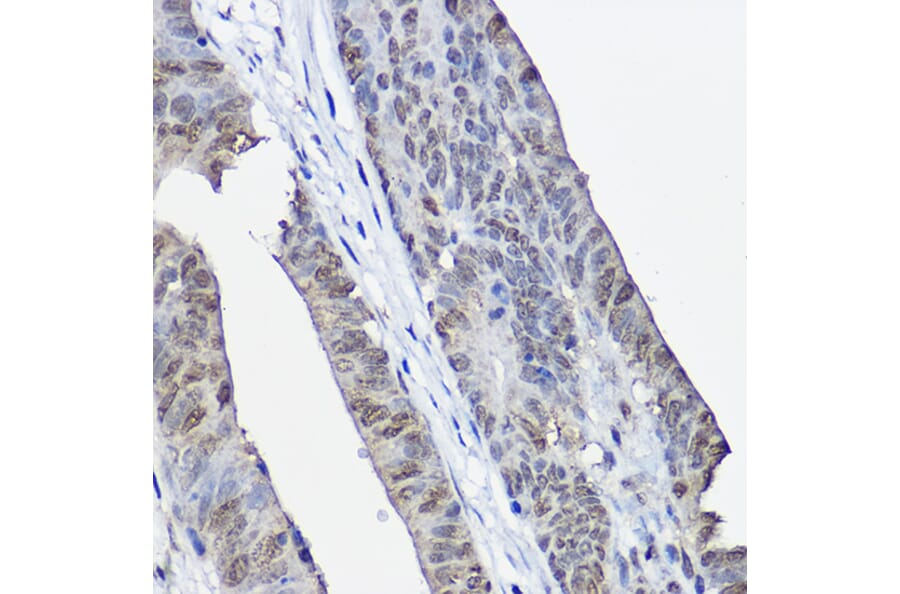 Immunohistochemistry - Anti-XPC Antibody (A10400) - Antibodies.com