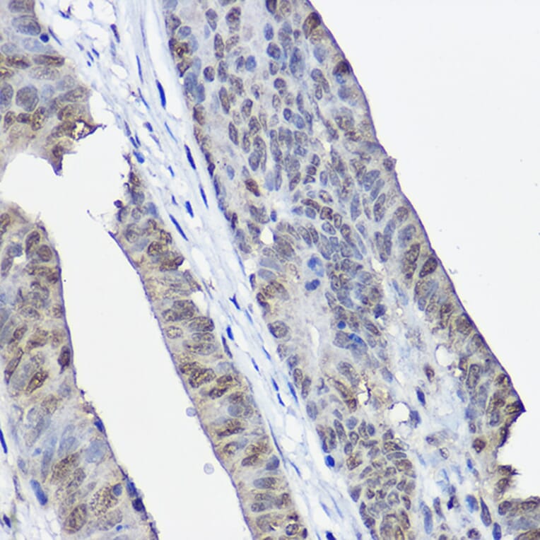 Immunohistochemistry - Anti-XPC Antibody (A10400) - Antibodies.com