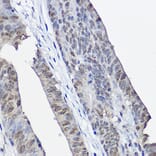 Immunohistochemistry - Anti-XPC Antibody (A10400) - Antibodies.com