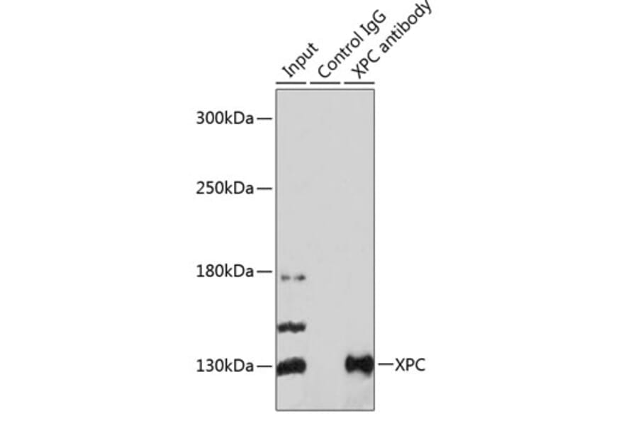 Western Blot - Anti-XPC Antibody (A10400) - Antibodies.com