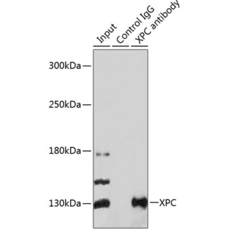 Western Blot - Anti-XPC Antibody (A10400) - Antibodies.com