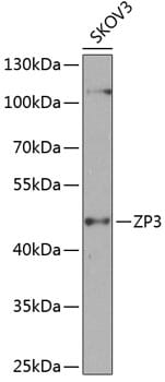 Western blot analysis of extracts of SKOV3 cells, using Anti-ZP3 Antibody (A8355) at 1:1,000 dilution.
Secondary antibody: Goat Anti-Rabbit IgG (H+L) (HRP) (AS014) at 1:10,000 dilution.
Lysates / proteins: 25µg per lane.
Blocking buffer: 3% non-fat dry milk in TBST.
Detection: ECL Basic Kit (RM00020).
Exposure time: 90s.