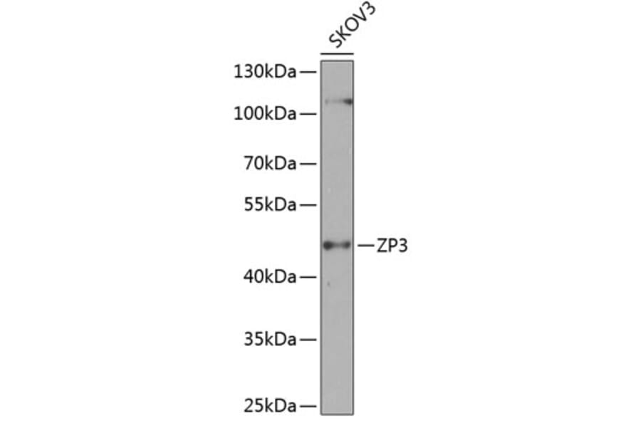 Western Blot - Anti-ZP3 Antibody (A10401) - Antibodies.com