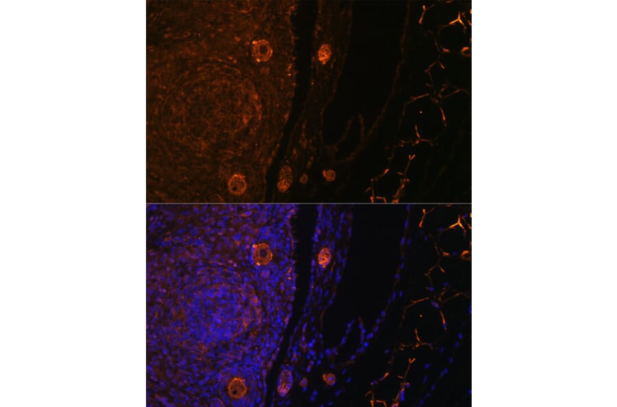 Immunofluorescence - Anti-ZP3 Antibody (A10401) - Antibodies.com